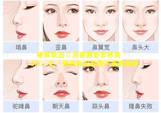 隆鼻取出 ☘ 后容貌会怎样变 🌻 化「隆鼻取出后能不能恢复到以前的样子」